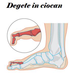 probleme cu articulațiile degetelor de la picioare de ce se creg articulațiile genunchiului
