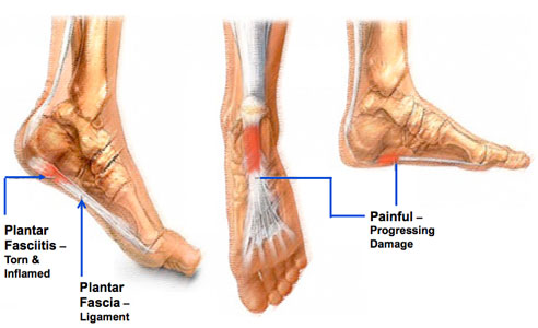 durere picior articulație mare deget de la picior împotriva durerilor articulare ce trebuie făcut