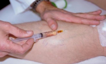 Top 5 cauze de ce apar varicele - Remedii naturiste pentru tratarea lor